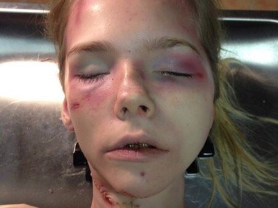 Young blonde female in morgue