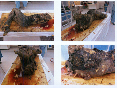 Autopsy images from Christian Larsson case