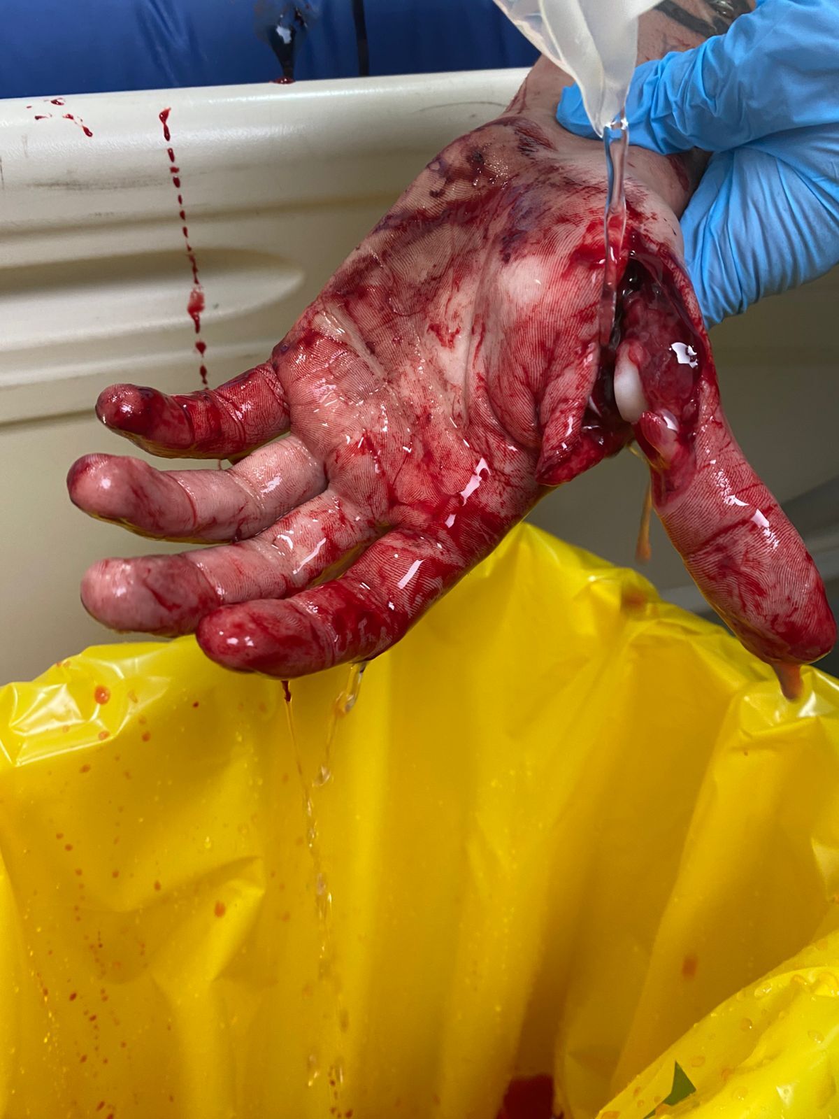 Colleague in processing plant attacks with butcher's knife