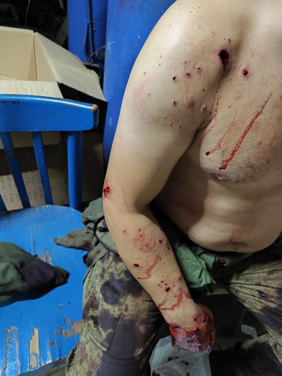 BROOO: Russian Soldier Injured 