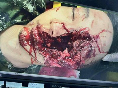 Soldier seriously injured in shooting accident in Taiwan, China.