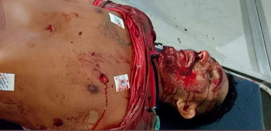 When even the Emergency Care Unit isn’t safe