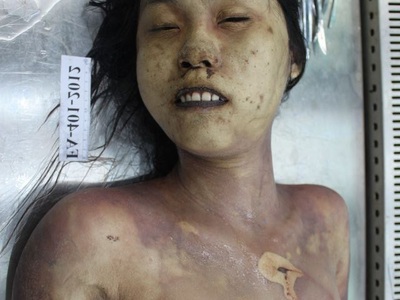 Examination nude dead corps of Chinese young women 