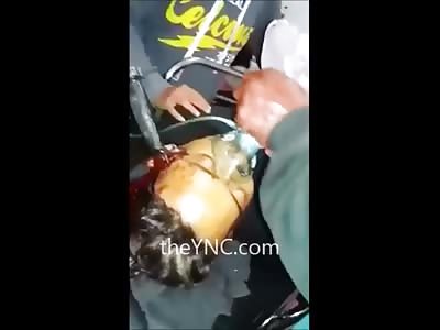 Man lives on with Giant Knife Stuck in his Head 