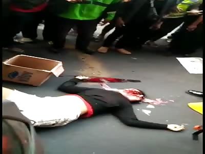 Head smashed in accident in street 