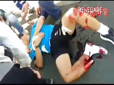 Shocking accident with man 