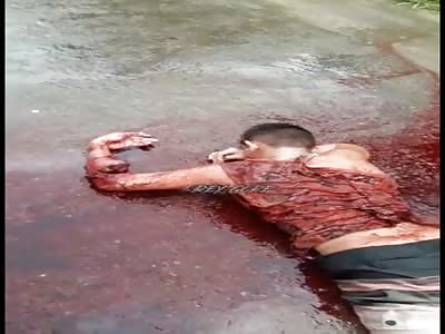 That's Some Serious Fucking Road Rash