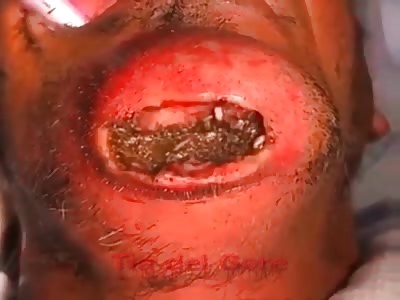 Maggots in the mouth of a rotting corpse - La Tía Del Gore 