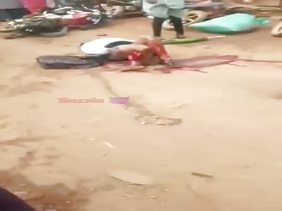 Biker with smashed legs.