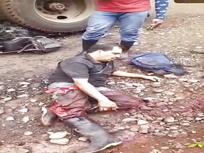 Biker with smashed leg.