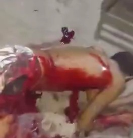 MAN IS SERIOUSLY INJURED AFTER BEING BLOWED WITH A MACHETE