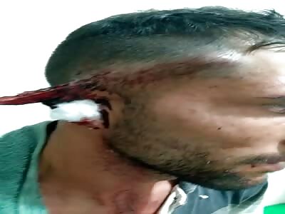 Small wooden splinter