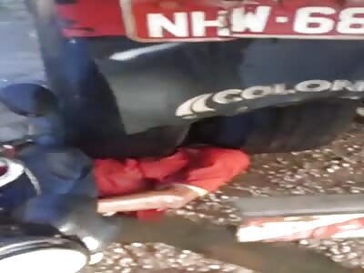 Man has his chest invaded by truck wheels