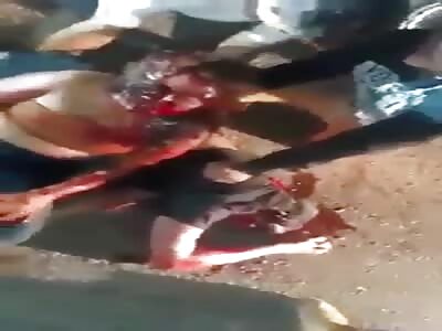 couple victim of serious accident