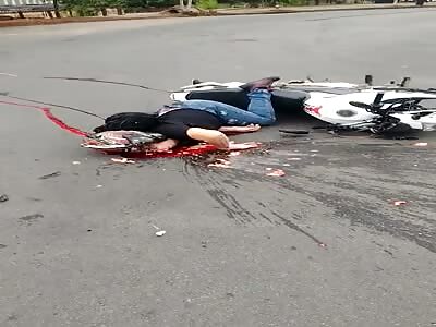 Man has his head crushed