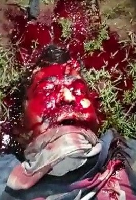 Gunmen Leave Dude Unrecognizable.