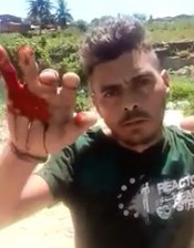 Both Hands Became Targets and Thugs Want to See the Result