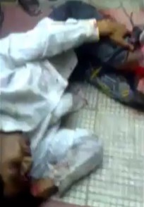 Man Tries to Stay Calm With Both Legs Ripped Off by Train