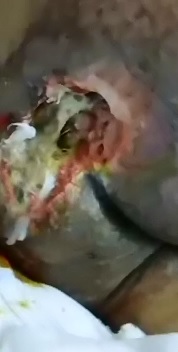 Disgusting Ass Ulcer must HURT like Hell 