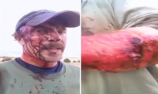 The Man that Survived the Grizzly Attack is One Bad Ass 