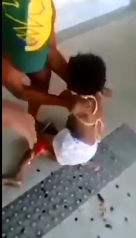 Poor Little Girl is a World of Pain after a Bus Mangled her Leg to a Mess..