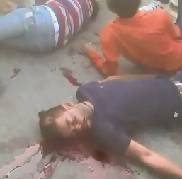 A Gory Mess...After Accident 2 Men in Agony 