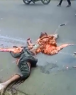 Horrific after Accident 