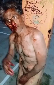 Idk What Happened to this Guy but he Ended Up Naked and Badly Bloodied Up 