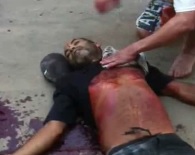 Last Breath after Being Shot!