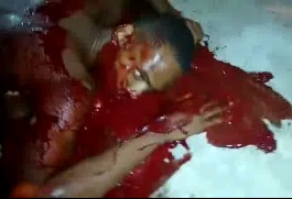 Dude Hacked up with Machete Bleeding in Total Fucking Agony