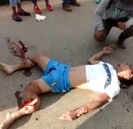 Two Guys Badly Injured in Accident