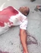 Dude Dying Shot 5 times