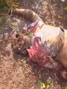 Dude Ripped Apart From Motorcycle Accident