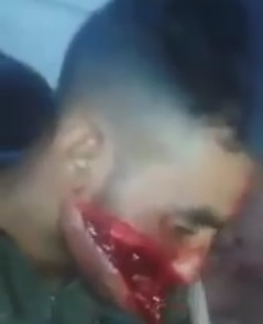 Man Hacked in Face Waits for Help