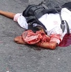 Man Scalped in Terrible Accident 