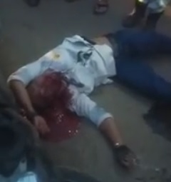 Dude Lies in total Agony after Bike Crash