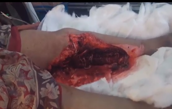 Womans Leg is Beyond Fucked