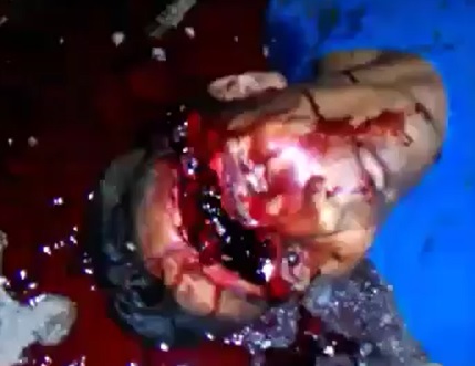 Dude Hacked with a Machete Staring at you With his One Good Eye