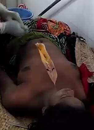 Autopsy on a Woman from India