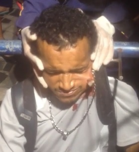 Mans Head Impaled on Iron Fence