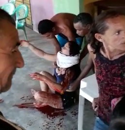 Pretty Girl Stabbed Bleeding Out