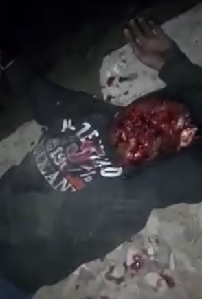 Aftermath of Suicide... Ewwwww