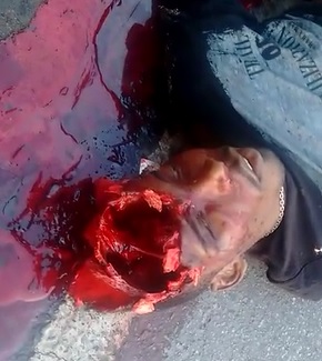 Dudes Brains Laying Next To Him