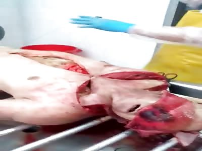 Absolute Carnage.. Ewwwwww