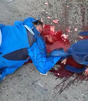 I Think He Might Live ... Heart Still Beating on Road