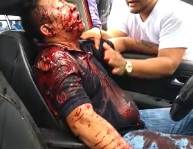 Better Angle of Dude Lit up with Bullets in His Car