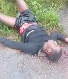 Dudes Intestines Spewing out... His Boys Dead