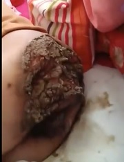 WHAT THE FUCK? Disease? Womans Ass is Gross