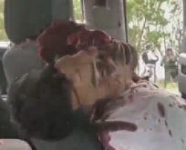 Somethin Wrong With Your Eye Bro