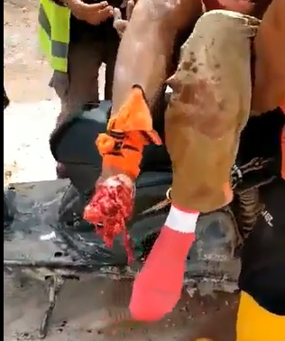 Bad Case of Athletes Foot?